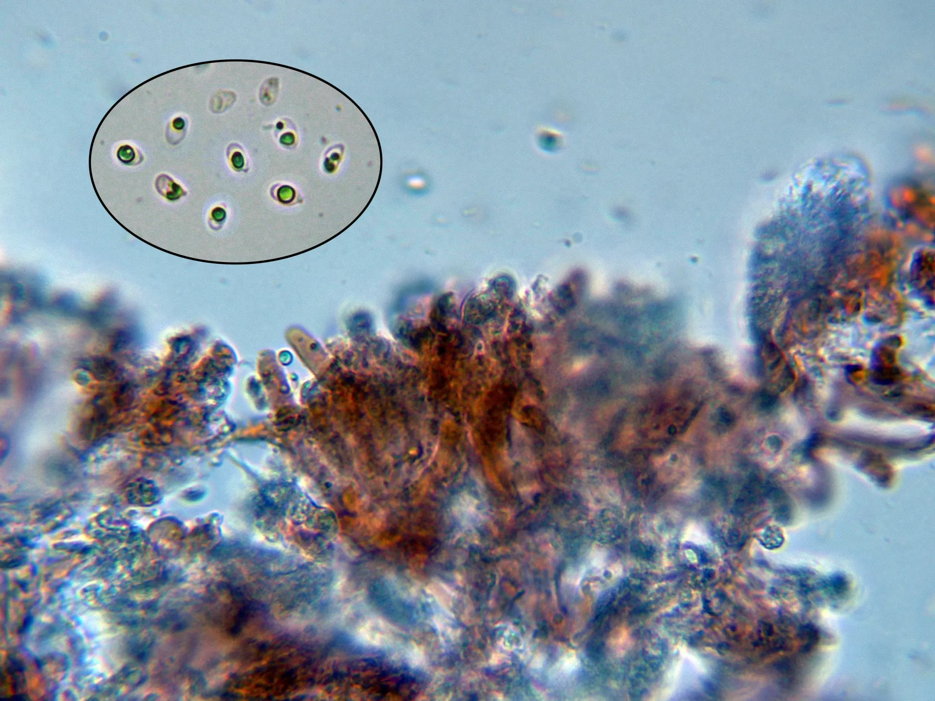 Microscopía de Scopuloides leprosa - 10 - Basidios y esporas